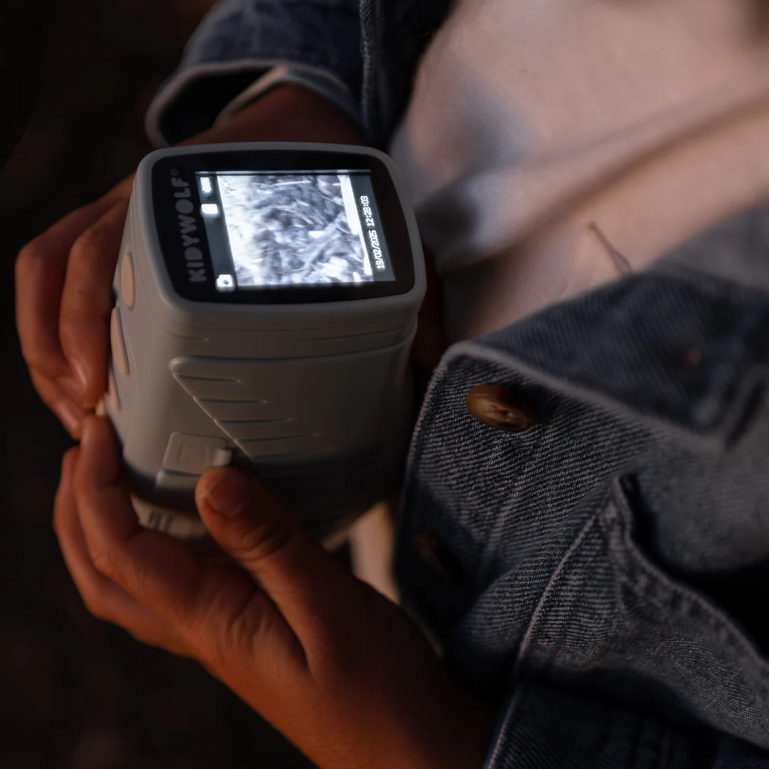 KIDYVISION - Image 5